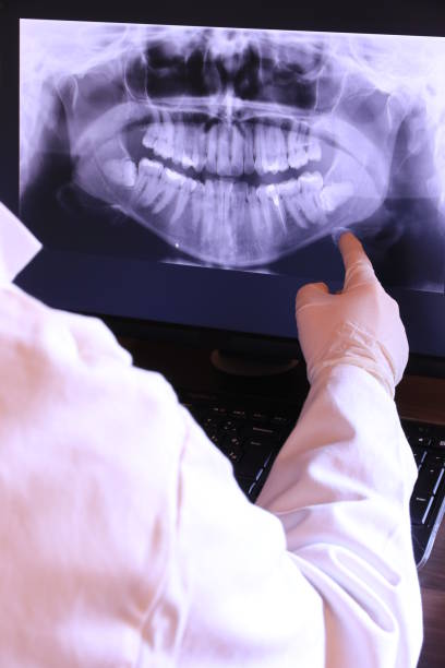 Best Emergency Tooth Extraction in Conover, NC